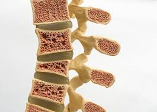 osteoporosis and sarcopenia {faces}